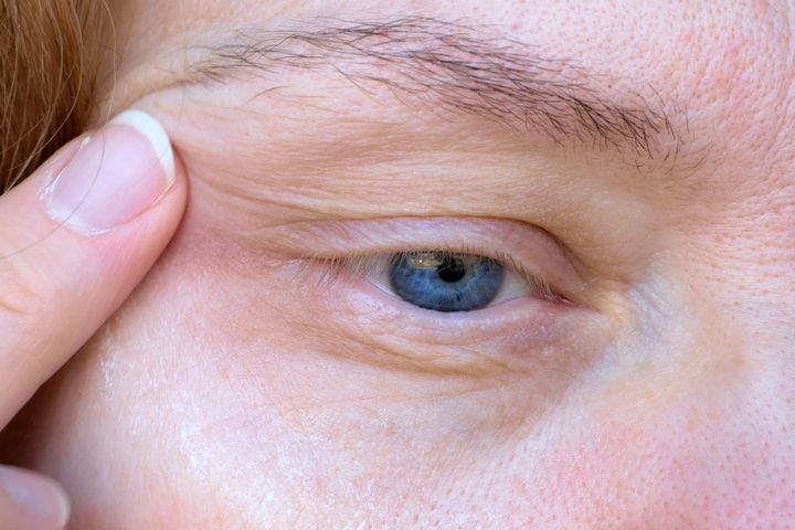 Włókna kolagenowe są głównym budulcem rogówki oka