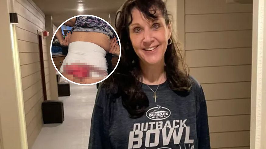 Chciała uratować małżeństwo. Operacja plastyczna była najgorszą decyzją w jej życiu