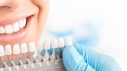 Demineralizacja zębów - przyczyny, objawy, leczenie i zapobieganie