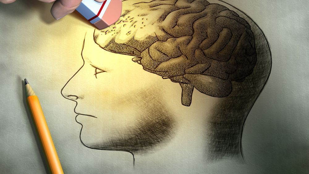 Alzheimer powoduje nieodwracalne uszkodzenia komórek nerwowych w mózgu