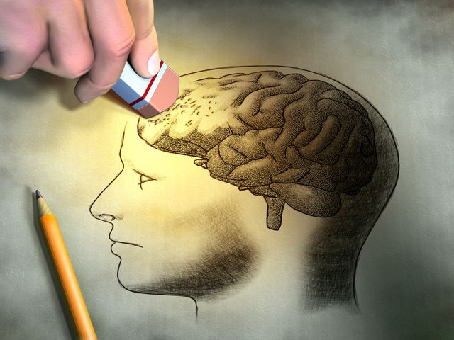 Alzheimer powoduje nieodwracalne uszkodzenia komórek nerwowych w mózgu