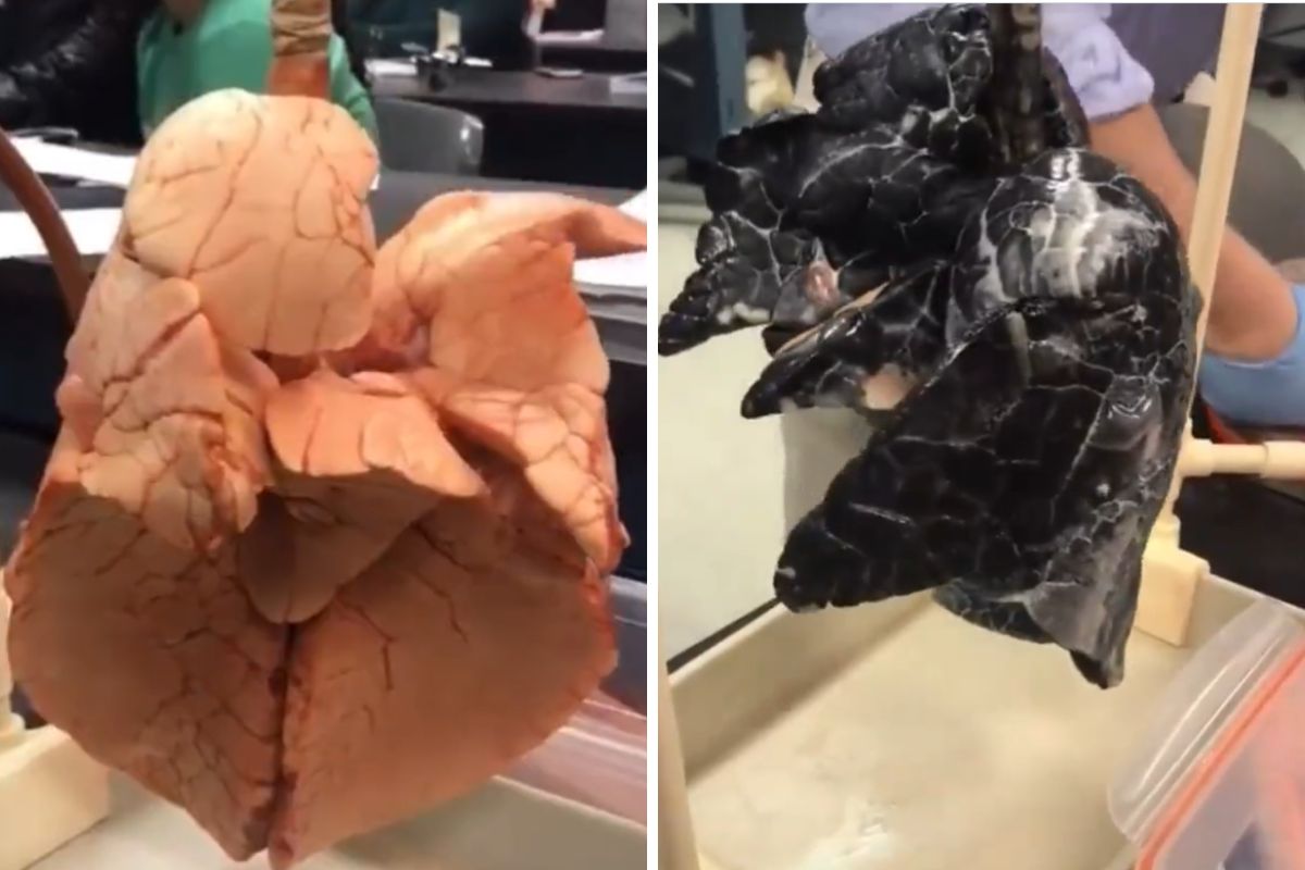 Jak wyglądają płuca palacza? Są czarne niczym smoła