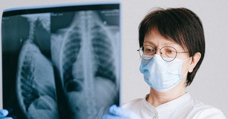 Tlen inhalacyjny - charakterystyka, bezpieczeństwo, opinia pulmonologa