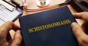 Schistosomatoza (bilharcjoza) - przyczyny, objawy, diagnostyka, leczenie, powikłania