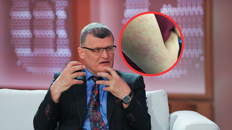 Zakażenie od komara. Pierwszy taki przypadek w Polsce