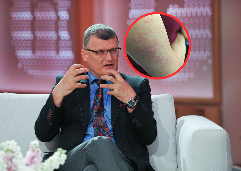 Pierwszy rodzimy przypadek Gorączki Zachodniego Nilu. Takie są objawy