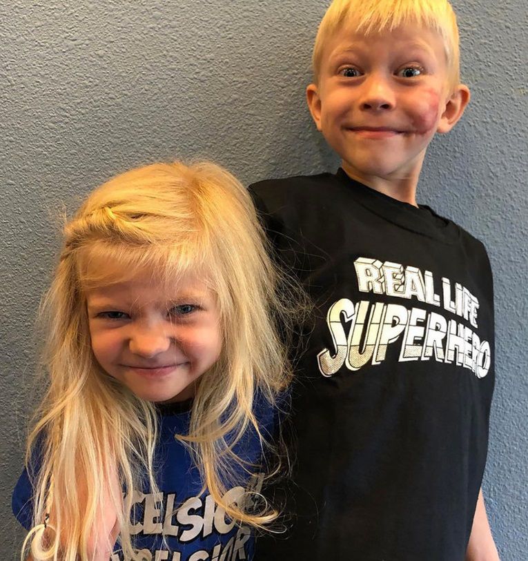 Chłopiec jest dumny ze swoich blizn, ale uważa, że postąpił po prostu jak brat