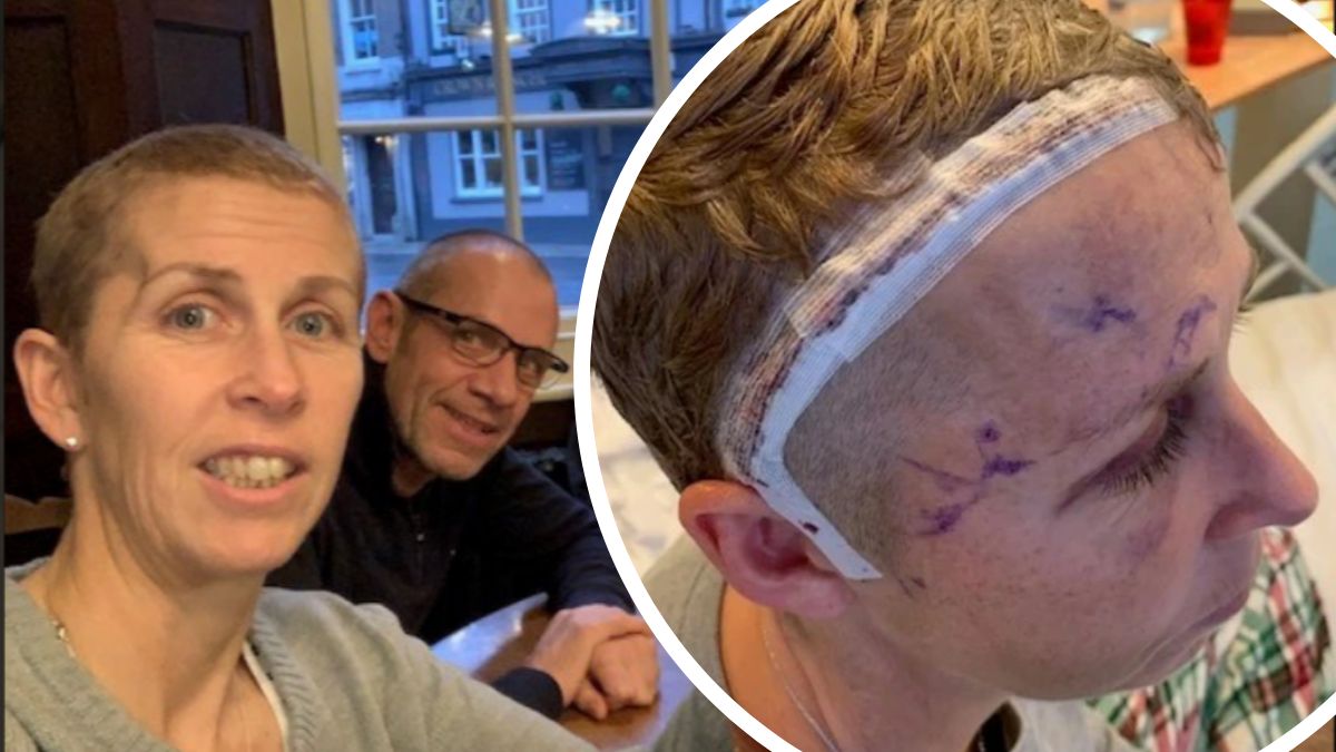 Myślała, że to menopauza. Uderzenia gorąca i mgła mózgowa były wywołane przez guza