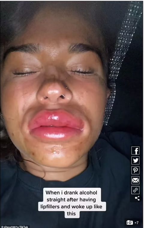 Następnego dnia jej usta wyglądały koszmarnie