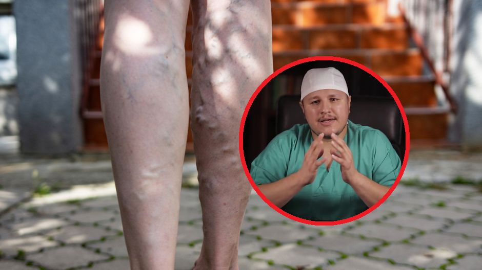 Lekarz wymienia 5 objawów, które mogą wskazywać na chorobę