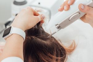 Laser frakcyjny a łysienie plackowate – zastosowanie i efekty