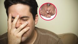 Zwiastuje udar. Znak, że skrzep przeszedł przez mózg