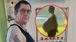 Niemiec miał mieć operację zmniejszenia żołądka. Wtedy lekarze coś odkryli