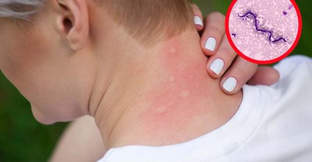 Lekarze ostrzegają. Komary występujące w Polsce mogą przenosić te choroby