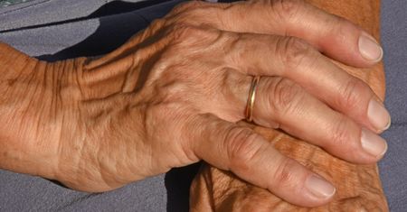 Ciężki przebieg COVID a wygląd palców. Zaskakujące badanie