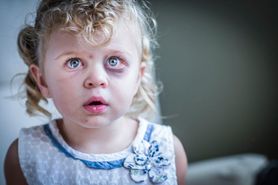 5 nieodwracalnych skutków bicia dziecka