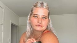 Modelka nie może się uśmiechać. Cierpi na bardzo rzadką chorobę