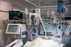 Dr Cholewińska-Szymańska: Szpitale są cały czas przepełnione. Jesteśmy blisko 100 proc. wykorzystania respiratorów (WIDEO)