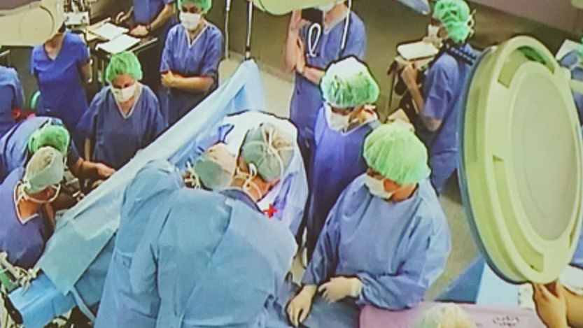 Lekarze w Olsztynie wykonali pierwszy w Polsce poród francuski