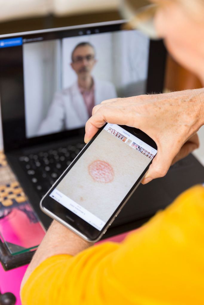 W drugiej połowie maja ruszy program teleopieki z analizą zmian skórnych