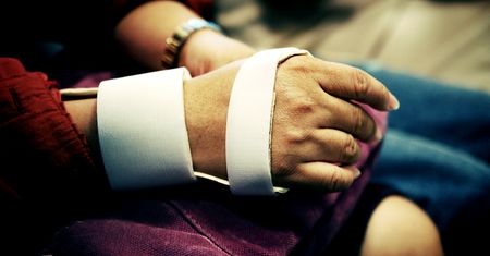 Złamania kości śródręcza i palców ręki - objawy i leczenie
