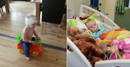 Rozlany glejak pnia mózgu rozwija się w ukryciu. Dziwny uśmiech u dziecka był objawem śmiertelnej choroby