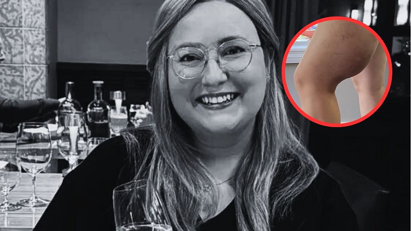 Lekarka z TikToka zmarła na raka. Takie są objawy