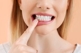 Odwapnienie zębów - przyczyny, objawy, leczenie, wybielanie szkliwa