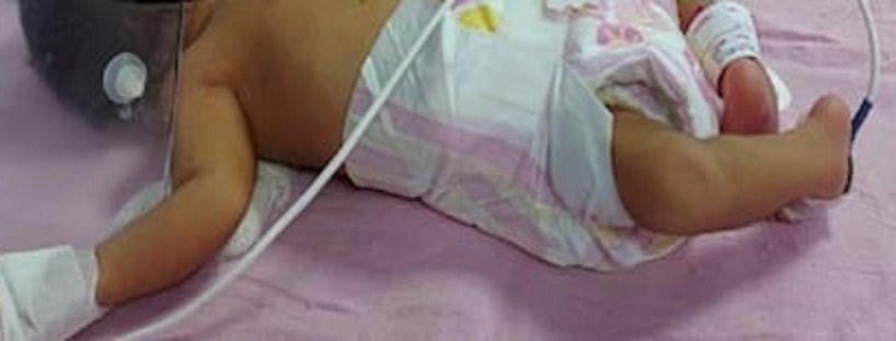 Noworodek jeden na milion