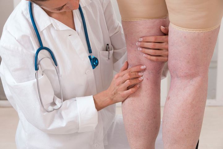 Opuchnięte nogi mogą być objawem wielu chorób
