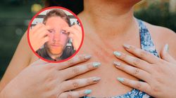 Lekarz mówi, jak poznać chorą wątrobę. "Objawy widoczne na skórze"