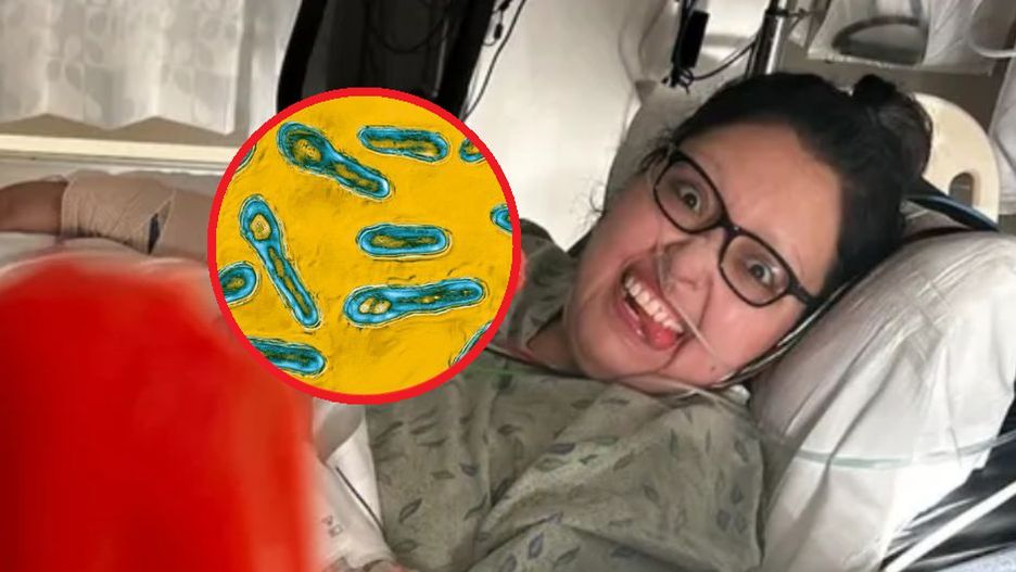 Zaatakowała ją mięsożerna bakteria. Samotna matka prawie straciła życie