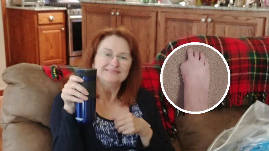 59-latka straciła palca u stopy przez pedicure. Apeluje, by zwracać uwagę na ważną kwestię podczas zabiegu