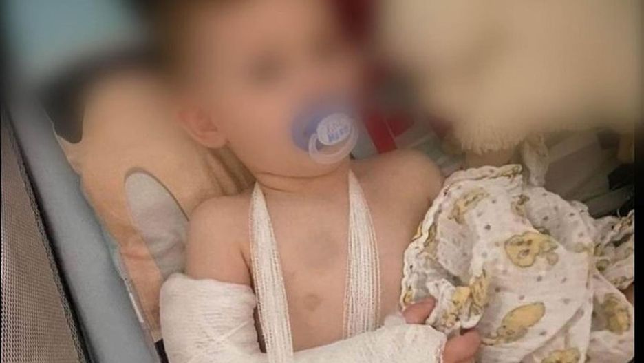 Zgotował dziecku piekło, bo chciał wyłudzić odszkodowanie?