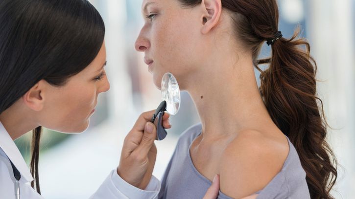 Brodawka łojotokowa to zmiana na skórze, którą warto skonsultować z dermatologiem.