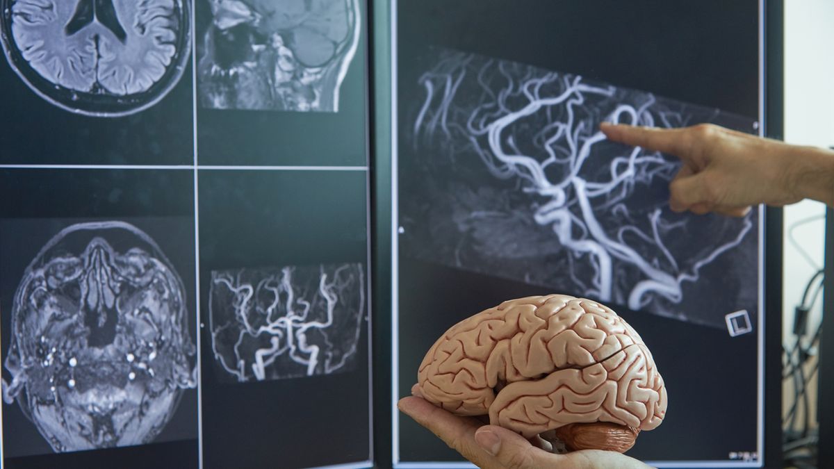 Leukoencefalopatia z zanikającą istotą białą spowodowana jest mutacjami genów