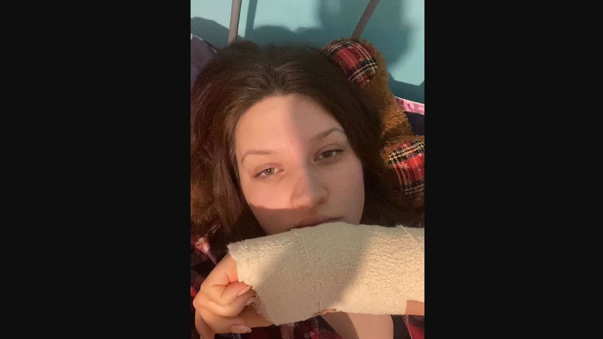 Rana po ugryzieniu mogła doprowadzić do sepsy