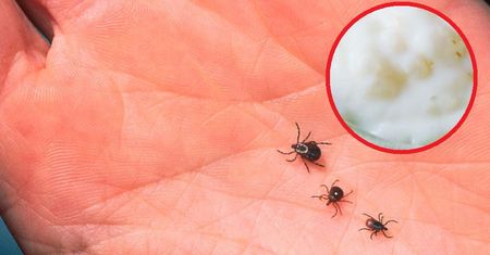 Genialny sposób na kleszcze. Nałóż cienką warstwę na skórę