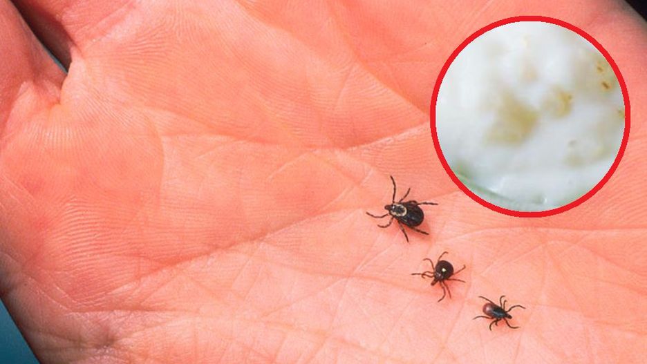 Genialny sposób na kleszcze. Nałóż cienką warstwę na skórę, będą cię omijać z daleka