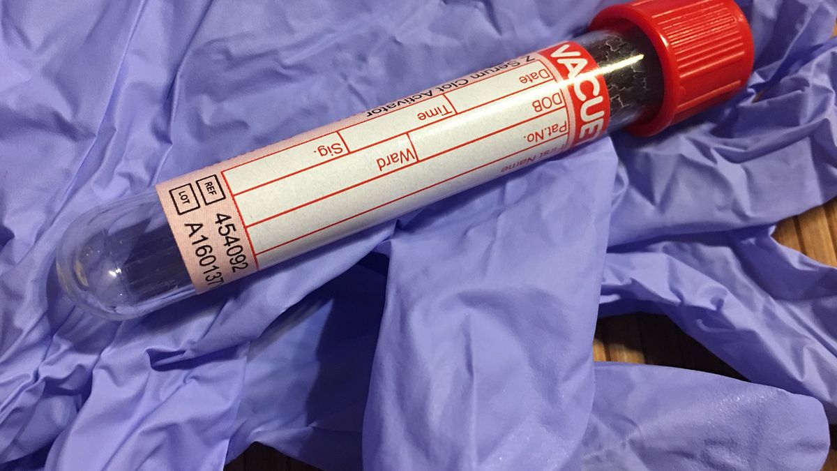 Lym morfologia odnosi się do liczby limfocytów obecnych we krwi obwodowej.