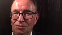 Trądzik różowaty. Rafał Bryndal szczerze o chorobie