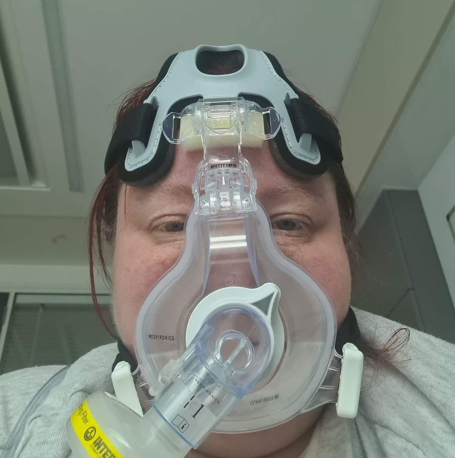 Lekarze oceniają, że powrót do zdrowia zajmie jej ok. 1,5 roku