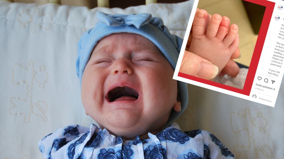 "Zespół opaski uciskowej" jest bardzo bolesny