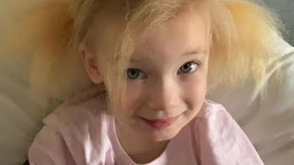 Keira cierpi na rzadką chorobę