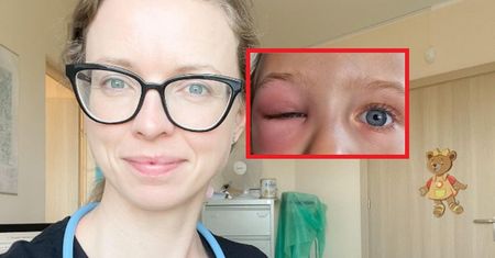 Lekarka pokazała zdjęcie. Tak może się skończyć ukąszenie komara