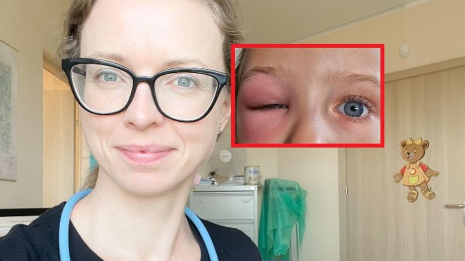 Lekarka pokazała zdjęcia dzieci. To efekt ukłucia popularnego owada