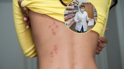 Refundacja od 1 stycznia 2024 r. Nowoczesny preparat ma 89 proc. skuteczności