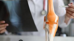 Osteoliza - przyczyny, objawy, diagnostyka i leczenie