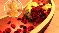 "Paliwo" dla komórek rakowych. Sprzyja nowotworom i przyspiesza powstawanie przerzutów