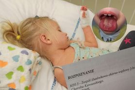 Koronawirus u dzieci. 2,5 latka wymiotowała i miała owrzodzenie na języku. "Ze szpitala wyszliśmy z diagnozą: PIMS o fenotypie Kawasaki"